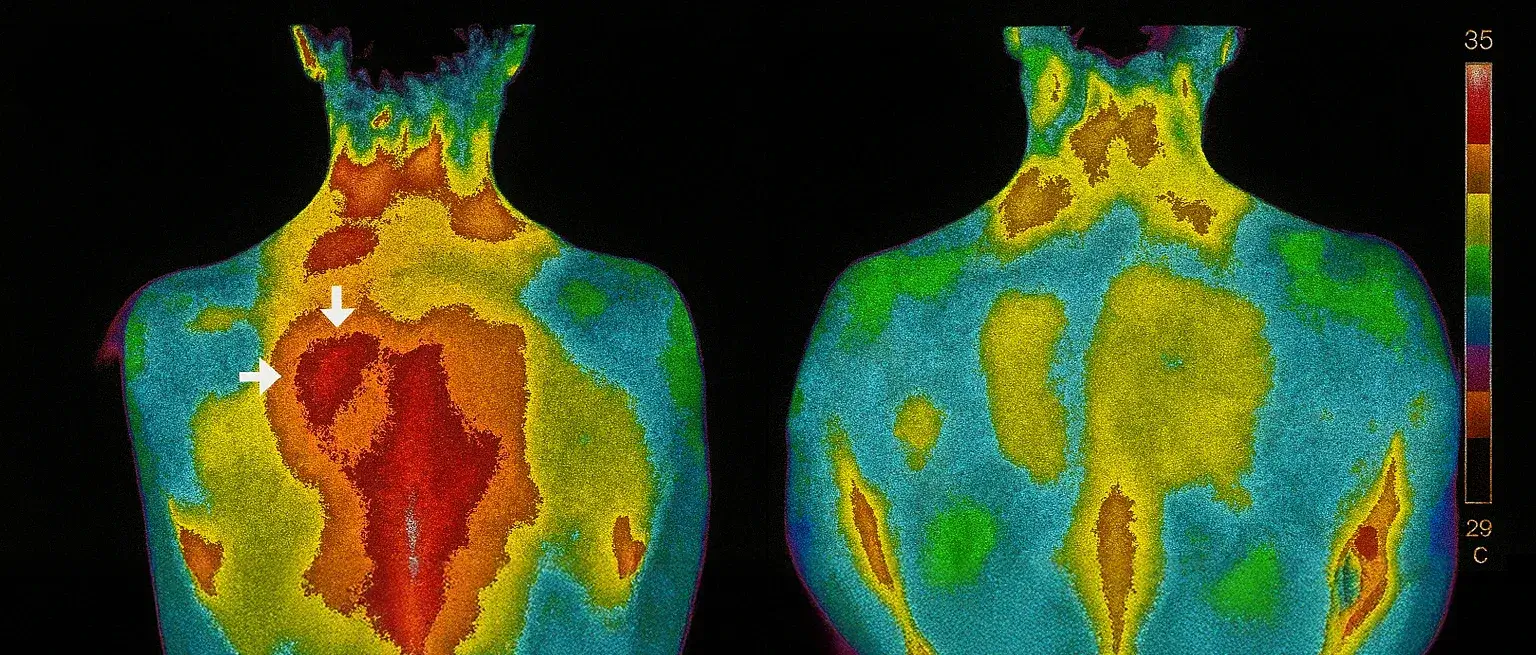 Thermal Before After